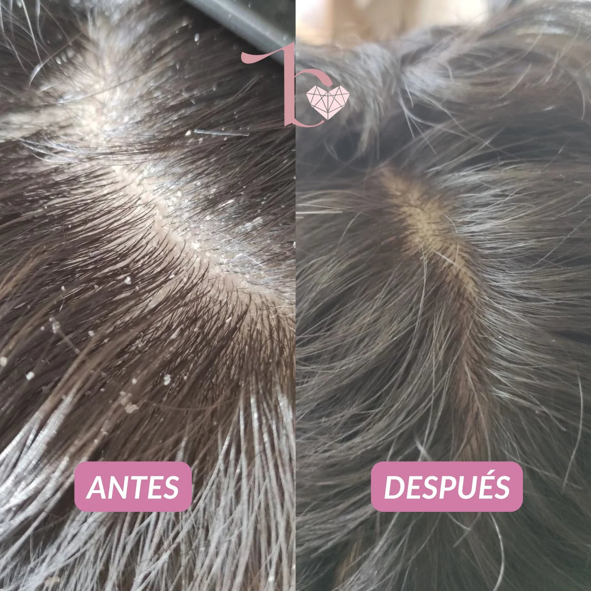 Agua Micelar Capilar 150ml