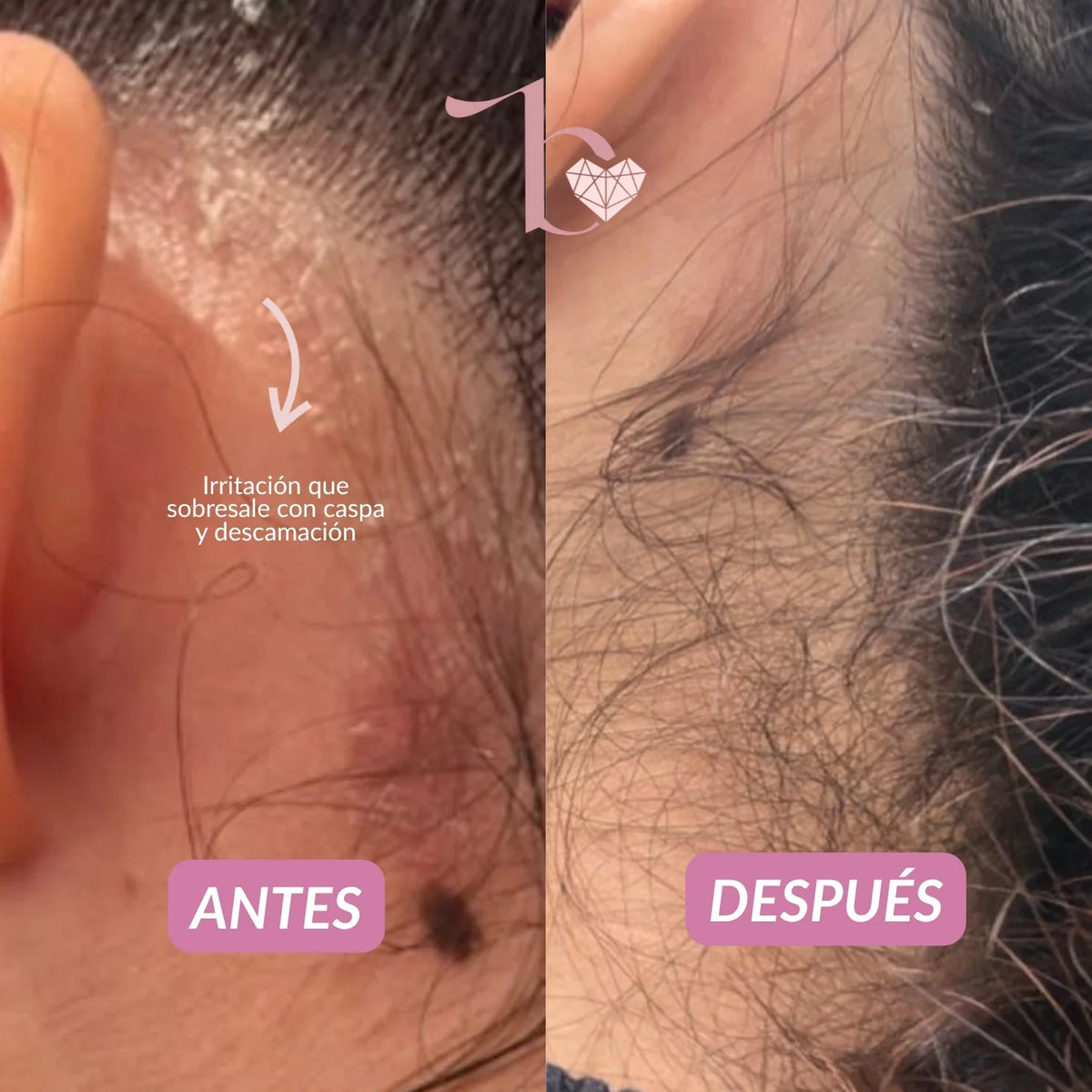 Agua Micelar Capilar 150ml