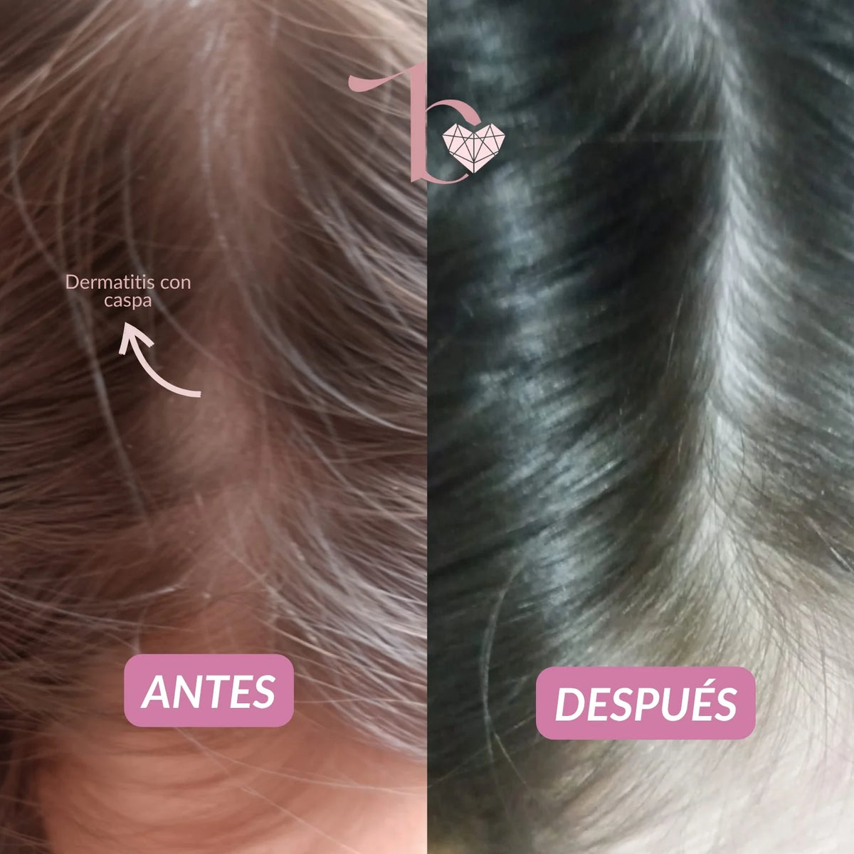 Agua Micelar Capilar 150ml